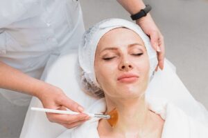 Chemical Peels Benefits