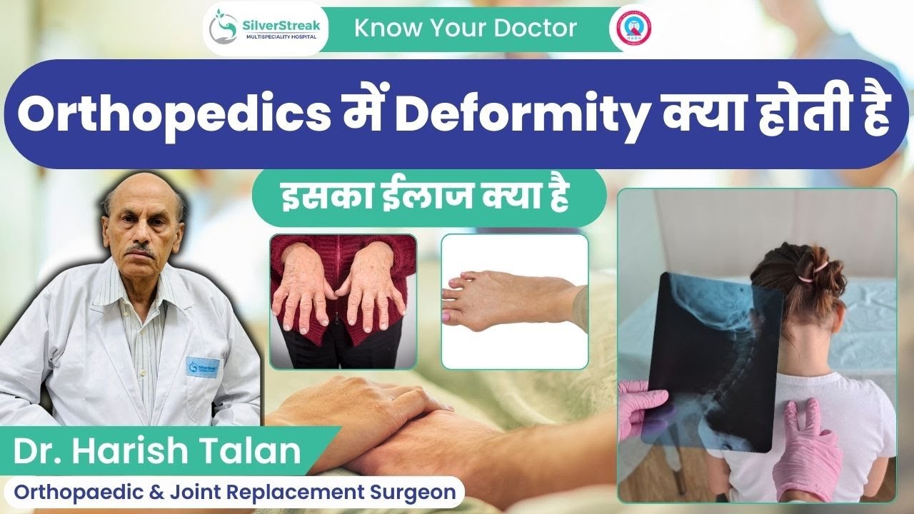 जाने Orthopedics में Deformity क्या होती है इसका ईलाज क्या है