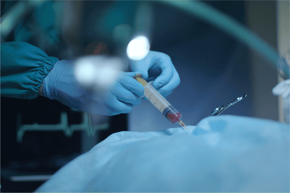 Anestesia_General-Anesthesia