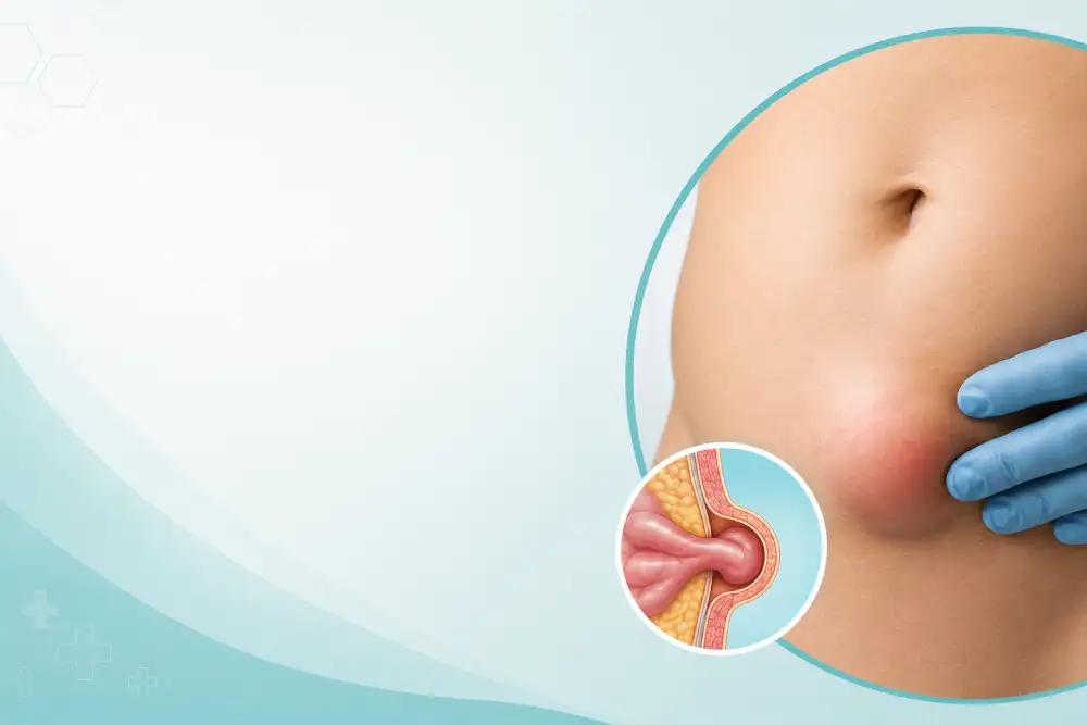 Advanced Hernia Treatment and Surgery