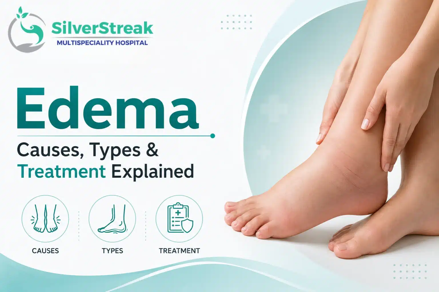 Edema: Causes, Types & Treatment Explained 