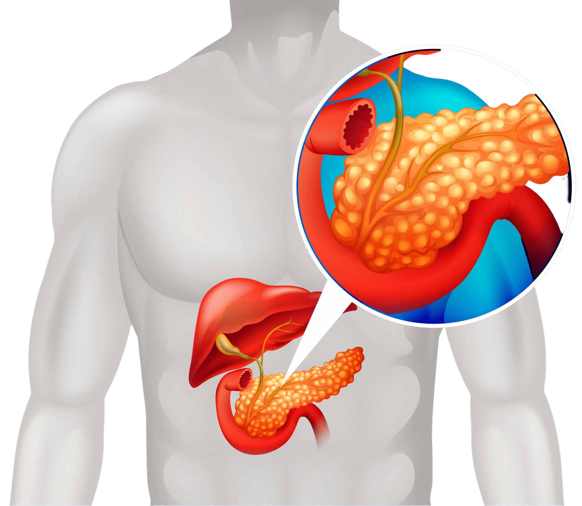 Gallbladder Stone Treatment