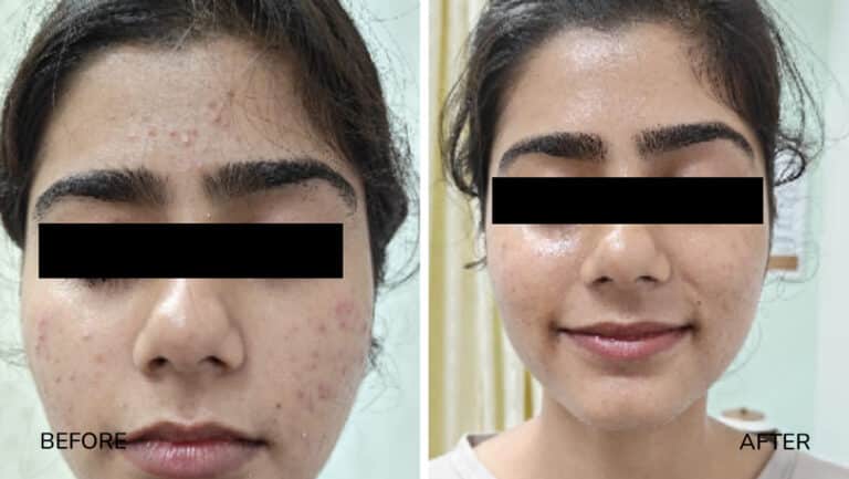 derma-1