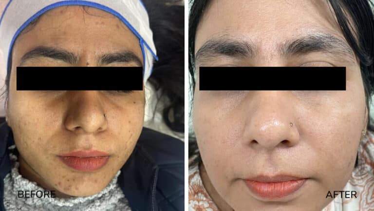 derma-2