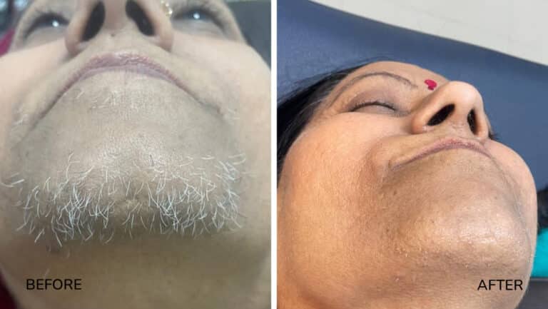 derma-6