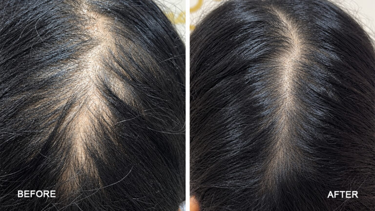 before after -2